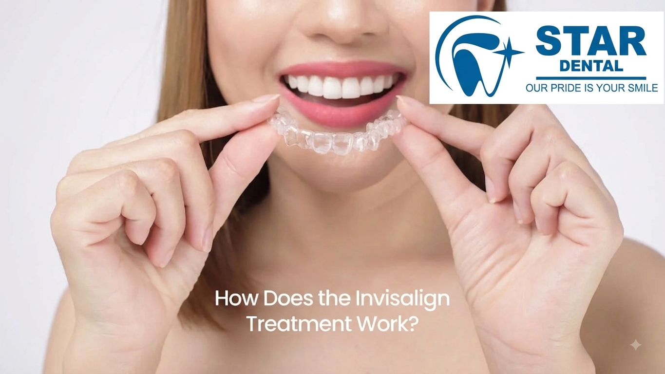 Invisalign® treatment at Star Dental Care